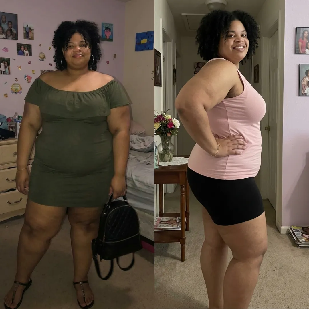 An Everglow Miami patient before and after