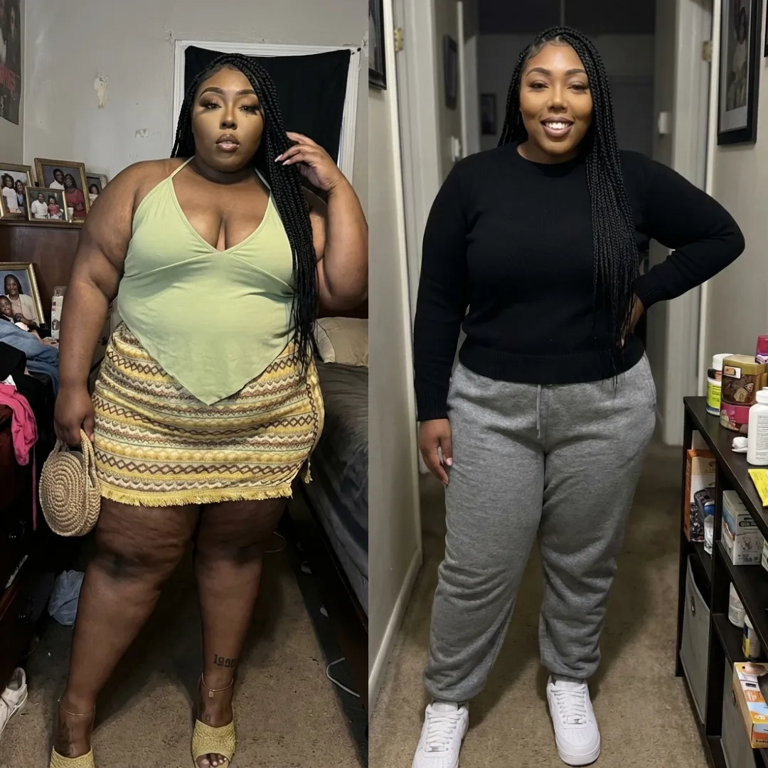 An Everglow Miami patient before and after